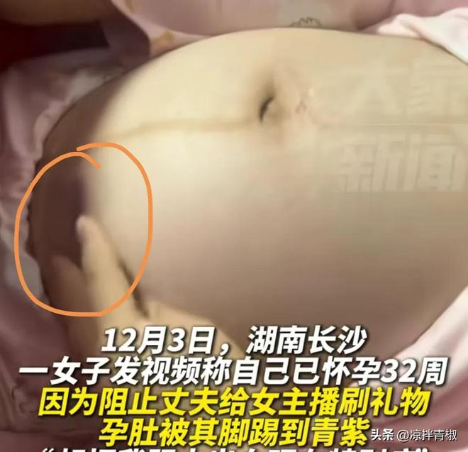 怀孕32周孕妇阻止丈夫给女主播刷礼物肚子被踹青紫!警方：人没事(图1)